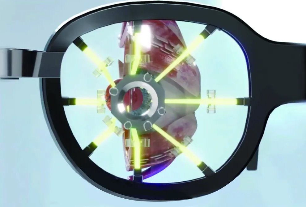 Kubota Glass® レンズから眼球への光照射